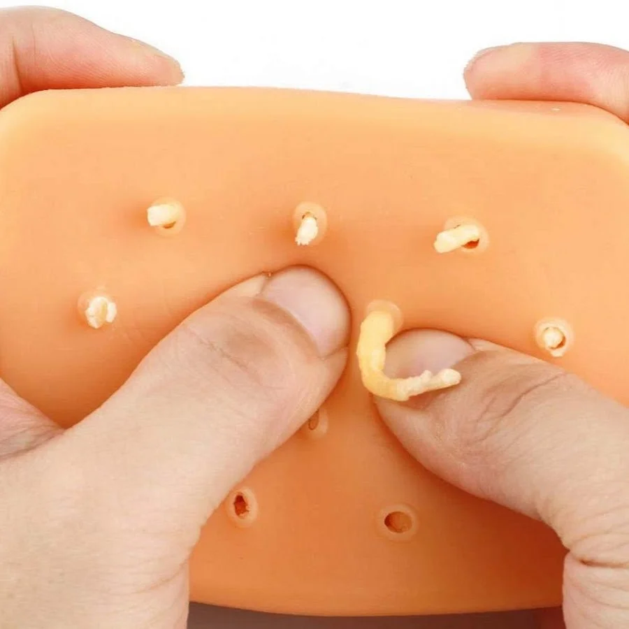 New Pimple Popping Videos