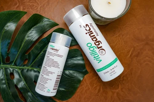 Vitilinox: A Promising Natural Solution for Vitiligo Management