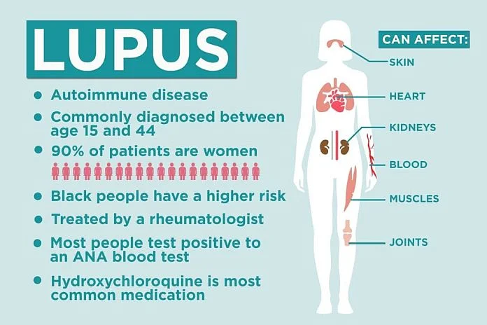 LupusNobiles: A Rising Force in Health Innovation
