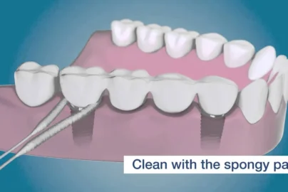 SuperTF Flossing