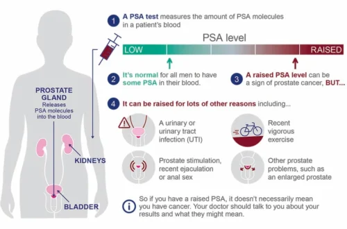 What is a Dangerous Psa Level After Prostate Removal?