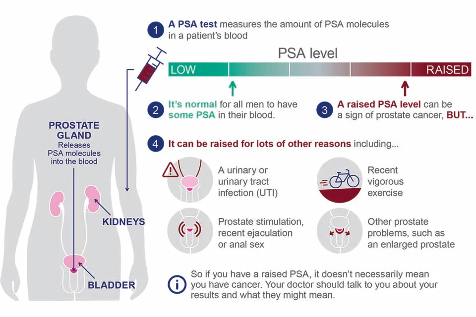 What is a Dangerous Psa Level After Prostate Removal?