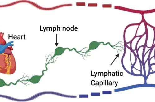 Lymfedeema: Causes, Symptoms, Treatment, and Living Well
