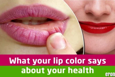 What Your Smile Says About Your Health