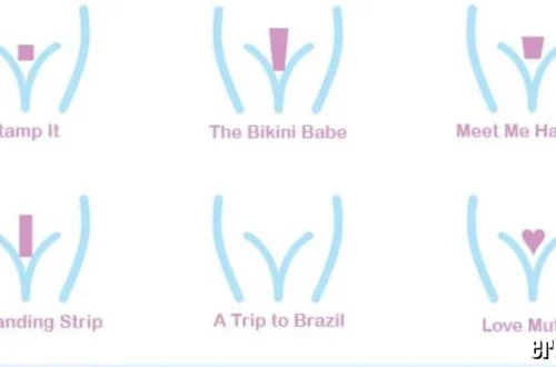 FUPA: Causes, Health Impact, and Treatment Options