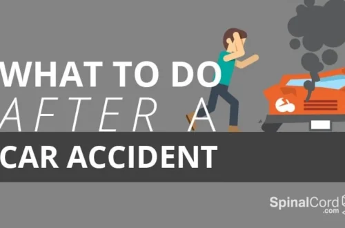 Protect Yourself: What to Do Post-Car Accident