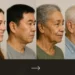 How Tooth Extraction Changes Your Face Over Time
